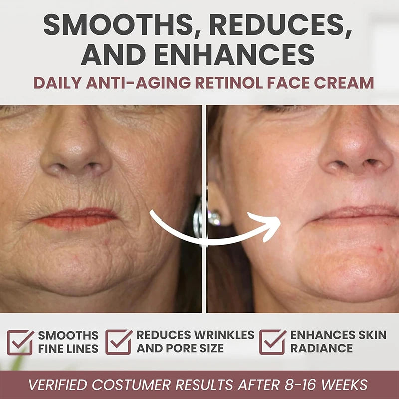 Retinol Skin Firming Cream – Advanced Anti-Aging Moisturizer