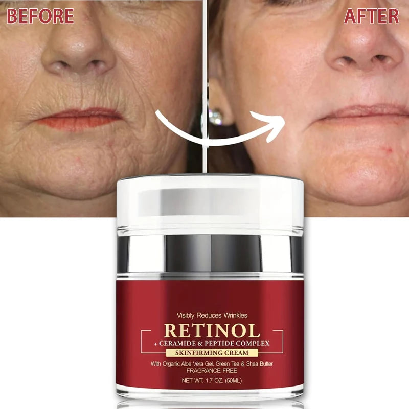 Retinol Skin Firming Cream – Advanced Anti-Aging Moisturizer