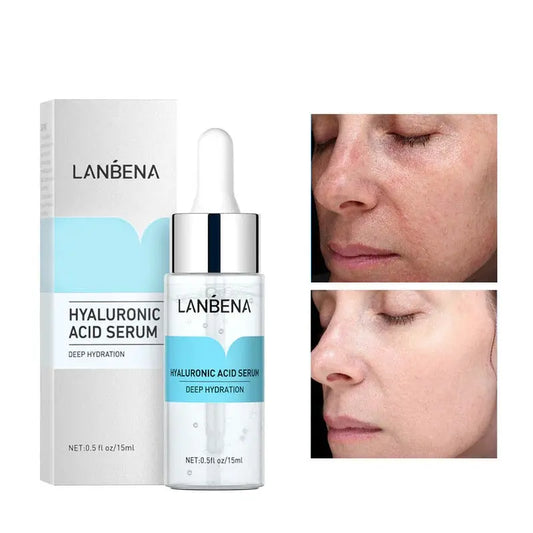 Hyaluronic Acid Serum: Benefits & How to Use for Plump Skin - The Little Corner Shop Online