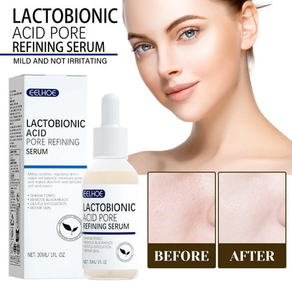 Lactosyl Acid Pore Narrowing Essence – Tighten Pores & Remove Blackheads eprolo