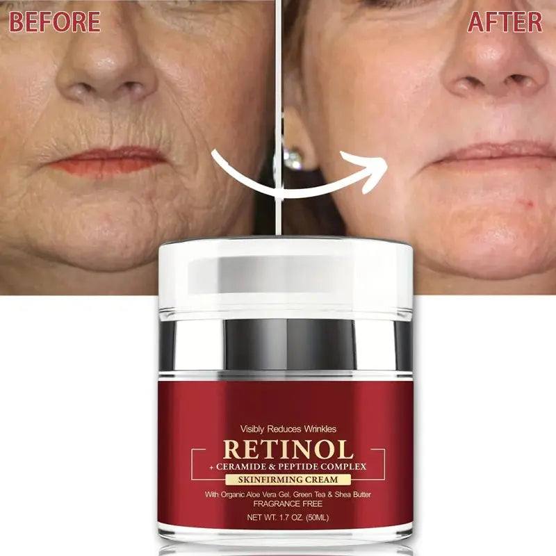 Retinol Skin Firming Cream – Advanced Anti-Aging Moisturizer eprolo