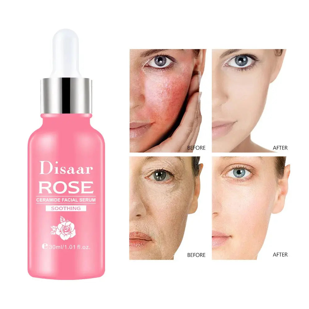 Rose Ceramide Facial Serum by Disaar – The Petal Touch eprolo