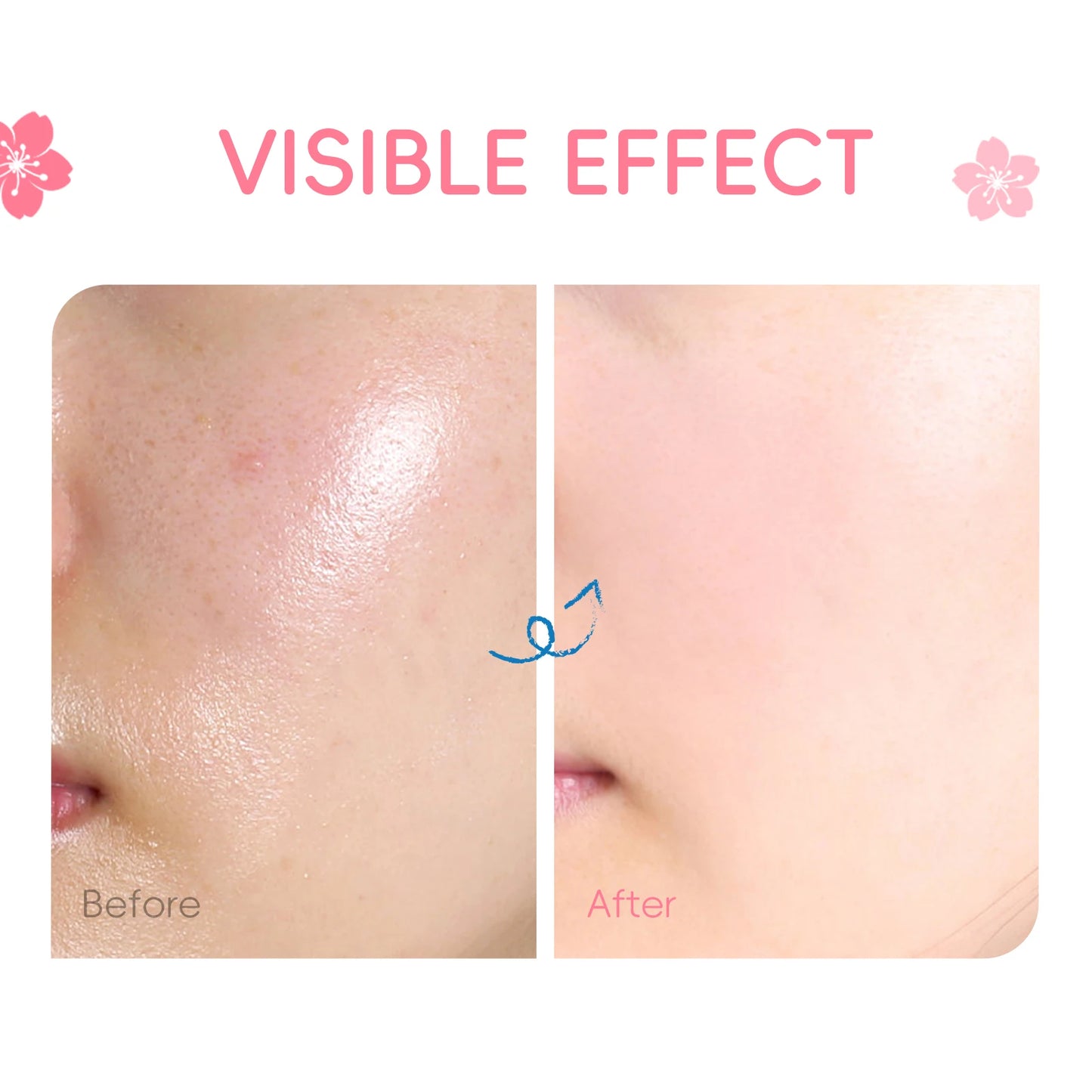 LAIKOU Japan Sakura Essence Cream Repair Anti Wrinkle Cherry Blossoms Whitening Moisturizing Face Skin Care