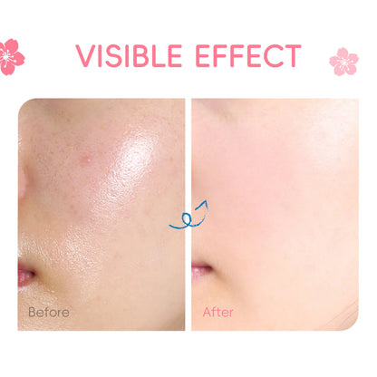 LAIKOU Japan Sakura Essence Cream Repair Anti Wrinkle Cherry Blossoms Whitening Moisturizing Face Skin Care