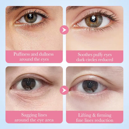 Sakura Collagen Eye Mask – Brightening & Firming | SADOER eprolo